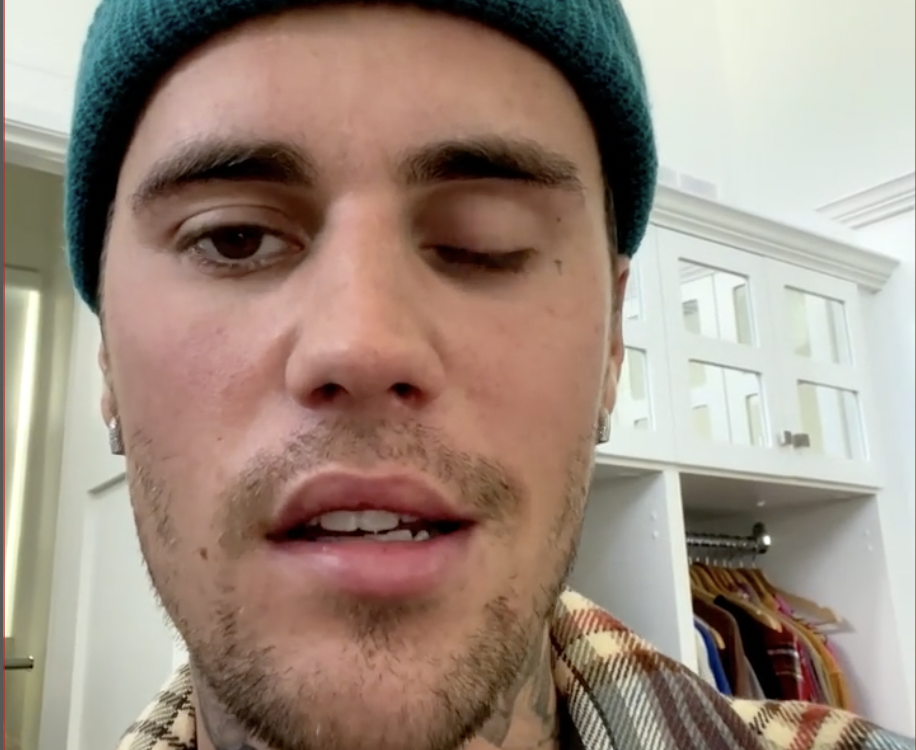 El cantante Justin Bieber ha compartido un vídeo donde muestra los efectos de la parálisis facial que sufre.