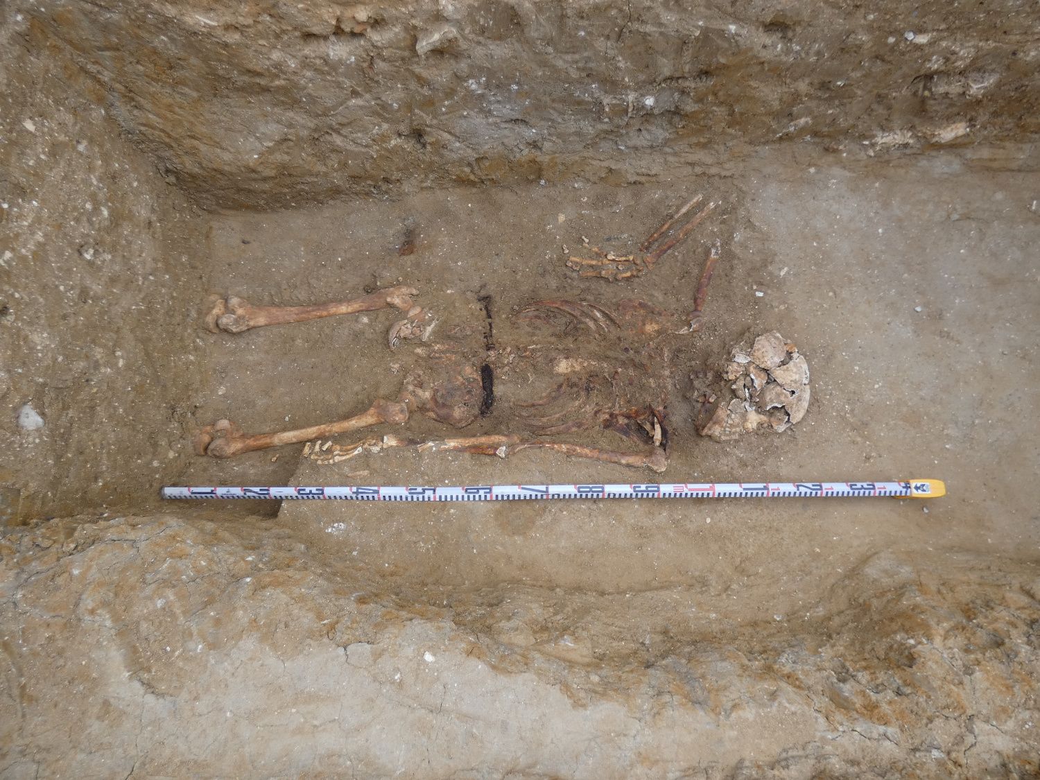 Los restos del represaliado hallado en una fosa en Sanlúcar.